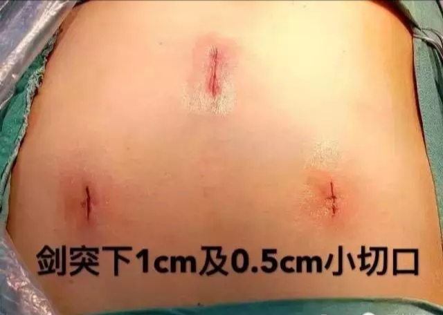 祝贺邓铁涛国医大师104大寿！将重症肌无力中西治疗发扬光大！