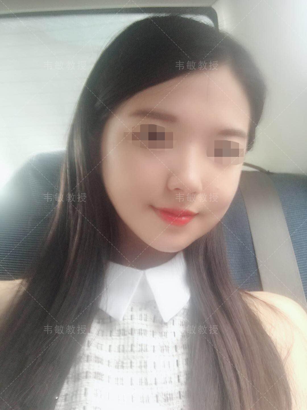 小方脸怎么整成鹅蛋脸,小方脸变美思路