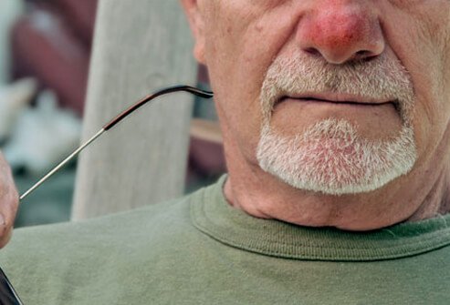 脱发与打鼾有关系吗,打呼噜和脱发的关系