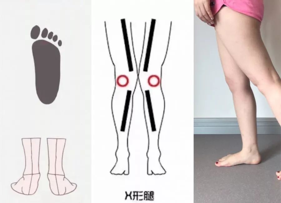 十分钟带你了解level,一分钟带你了解高低肩