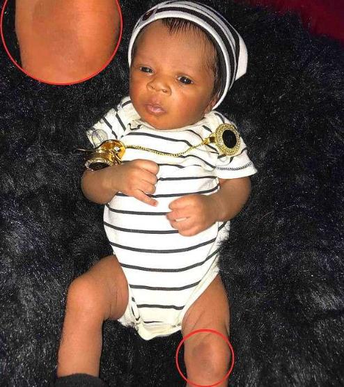 特殊的胎记前世事例,世上最独特的胎记