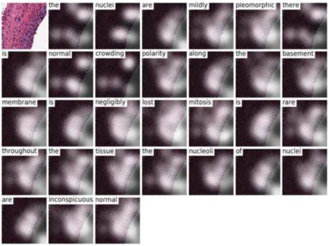 浅谈医学影像技术,医学图像分析深度学习模型