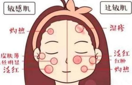 敏感肌的皮肤如何调理,皮肤是敏感肌容易过敏怎么修复