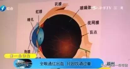 福州男子喝酒胃里全是血,福州一男子倒地吐血