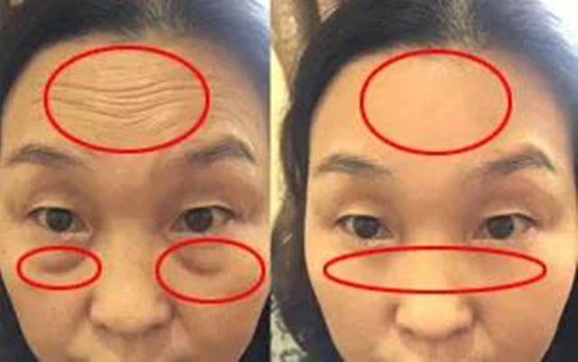 女人刚过30就肤色暗黄？想要“换皮”，先搞清楚这3件事