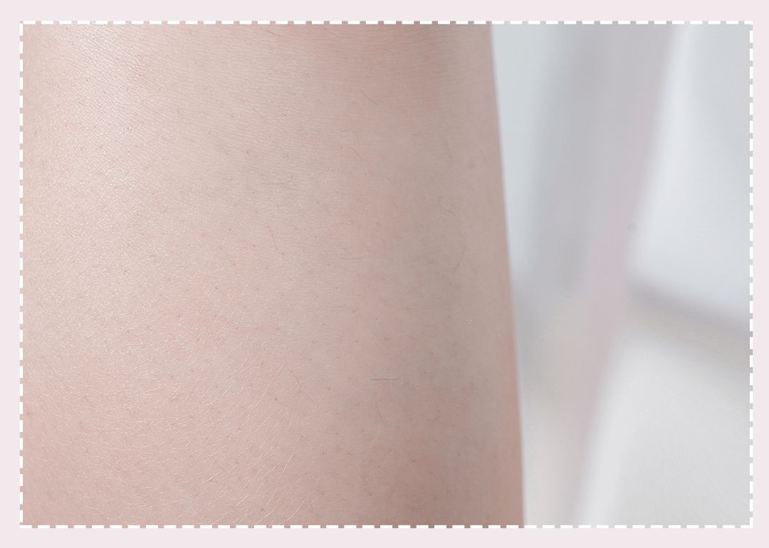 体毛脱毛的效果怎么样,天生体毛旺盛的人正常吗