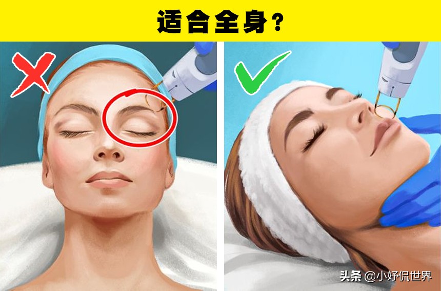 女性脱毛骗局,来看看脱毛误区你中了几个