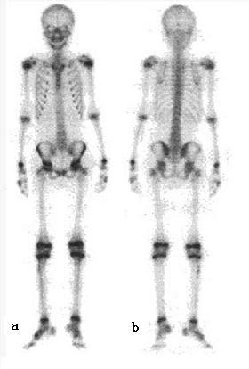 居里夫妇、镭、“派特洗梯”（PET/CT），与医学影像有什么关系？