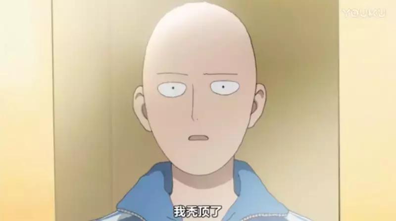 90后已经开始秃发,90后就秃了头