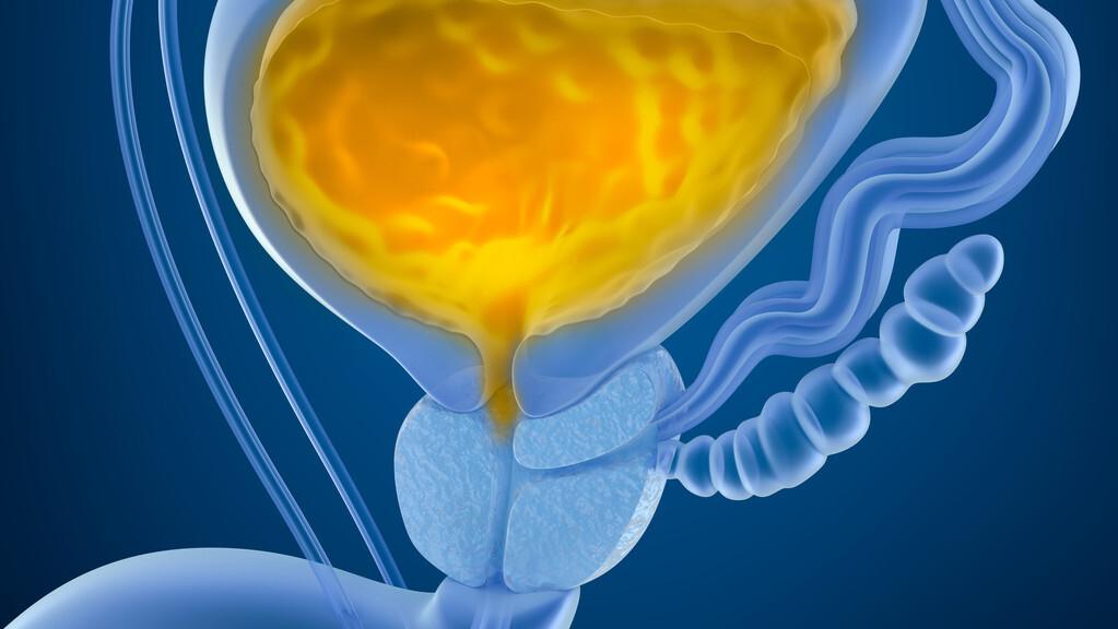 导致尿黄的各种原因,解小便感到小便烫是什么原因