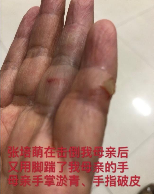 苏炳添说张培萌家暴是真的吗,苏炳添张培萌为什么打岳母