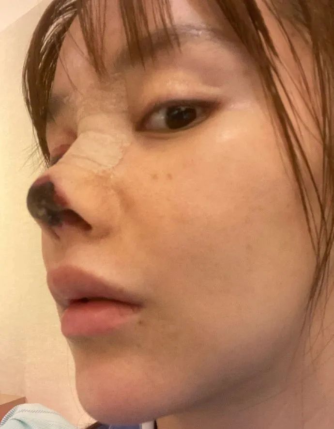 女艺人整容失败有哪个,女演员整容失败变老视频