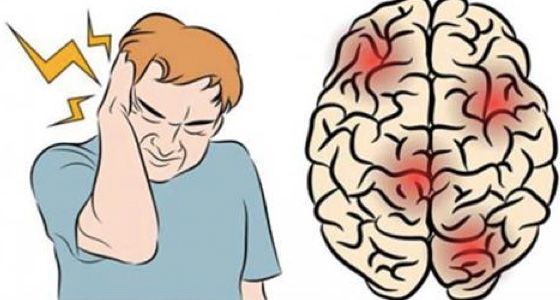 中医治疗偏头痛药,中医治疗偏头痛有效的药