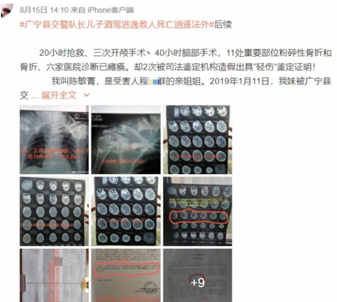 广宁县一交警中队长儿子酒驾撞伤医生逃逸案再起波澜，该伤者因病去世，其伤情3次鉴定由轻伤、重伤再转轻伤