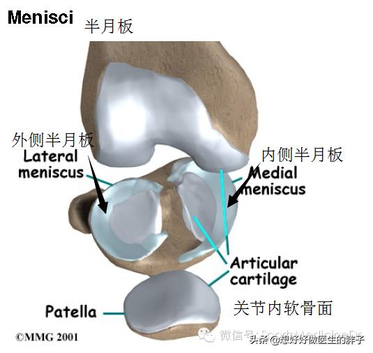 半月板损伤通常是单膝还是双膝,你知道半月板是什么吗