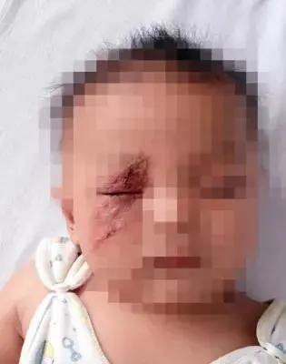 熬夜玩手机女性危害,女生熬夜玩手机导致失明