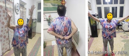 肩关节后脱位肩袖修补术,肩关节习惯性脱位修复手术评残