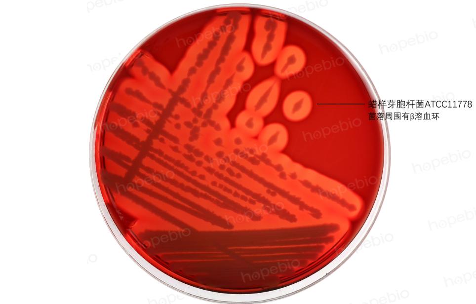 细菌溶血现象的原理,细菌革兰染色实验报告