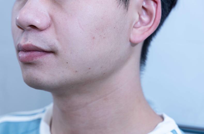 小米有品众筹健身,小米有品众筹怎么提高中奖率