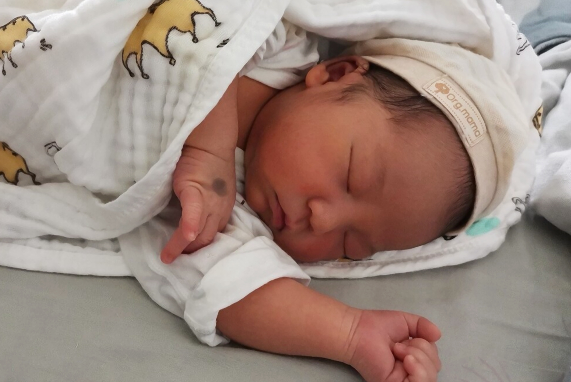 宝宝头上斑秃是什么原因造成的,是不是每个宝宝都秃顶