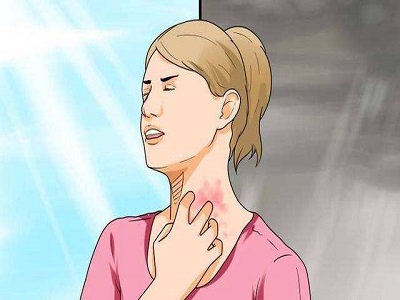 过敏性皮炎与神经性皮炎症状区别,什么是皮炎皮炎是怎么引起的