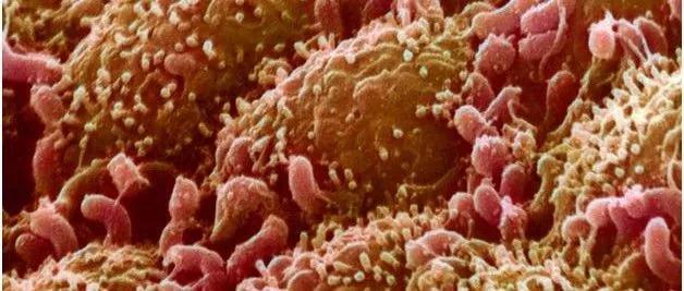 热搜第一粪菌移植治疗自闭症,厦门医院粪菌移植治疗自闭症