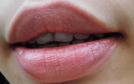 5秒恢复嘴唇水润,告别唇部暗沉、细纹