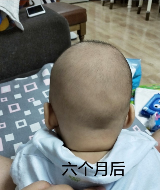 不做后悔妈妈,偏头的宝宝怎么做才能调整过来