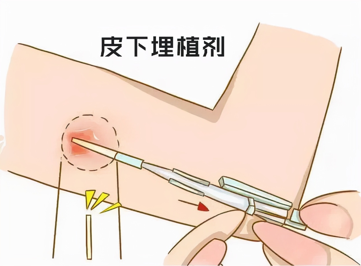 世界避孕日活动感悟,世界避孕日主题活动策划案