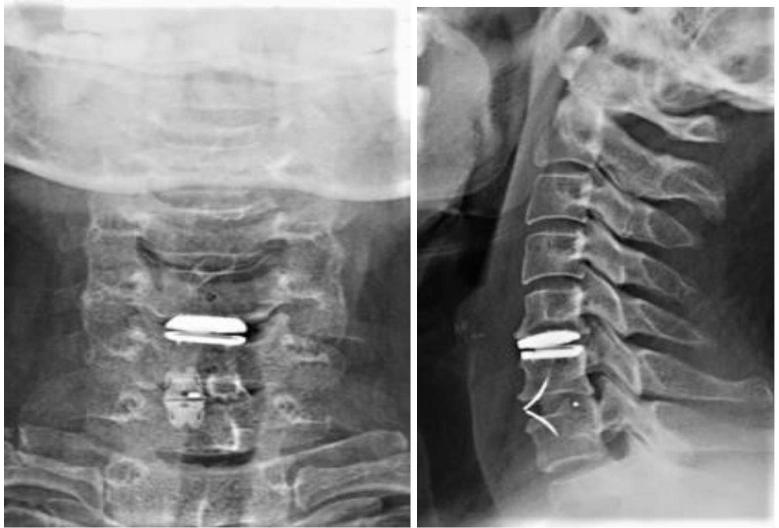 张忠根教授授课简介,李春根发改委
