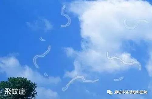 年龄大了飞蚊症恢复最简单,年纪轻轻得了飞蚊症