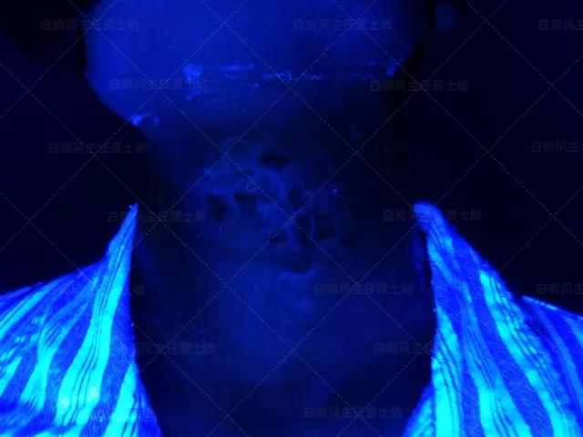 18岁男孩高考备战,18岁男孩白斑