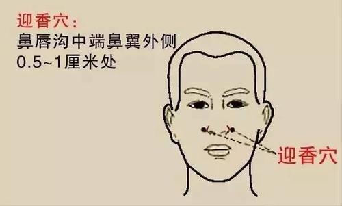 艾灸鼻窦囊肿有用吗？鼻窦囊肿艾灸哪里效果好？