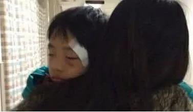 孩子被家长打出淤青犯法吗,孩子被孩子打淤青怎么谈赔偿