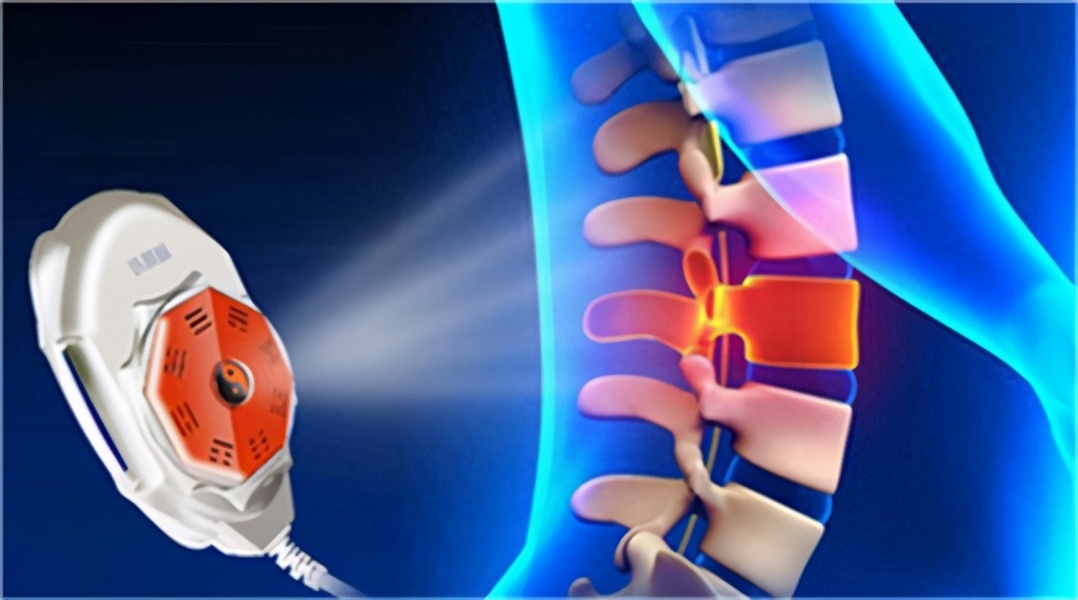 青岛伍龙铁腰板靠谱吗,伍龙科技铁腰板腰突治疗仪