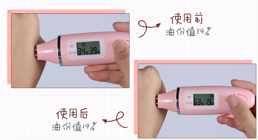 脸上长闭口怎么办有效的去除,长闭口痘痘的原因和改善方法