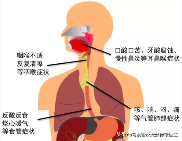 心脏大量反流会头晕胸痛吗,胸痛心悸头晕