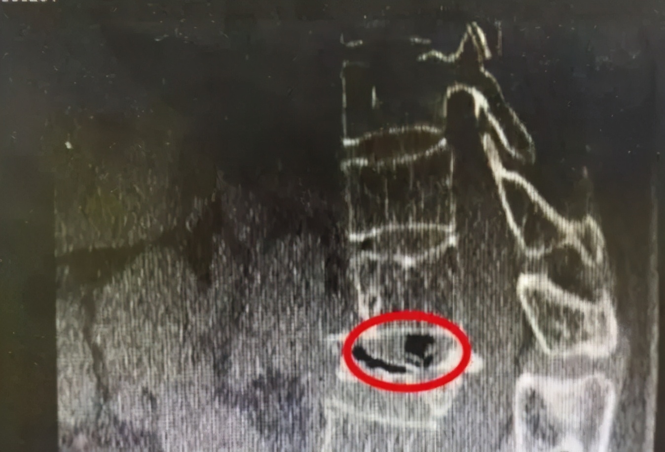 被“白嫖蹭睡”的共享按摩椅，烧光5亿难逃一死