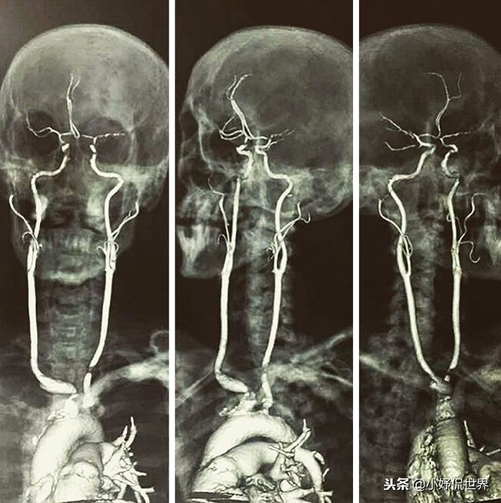 教科书照片与现实照片,教科书图片里的人
