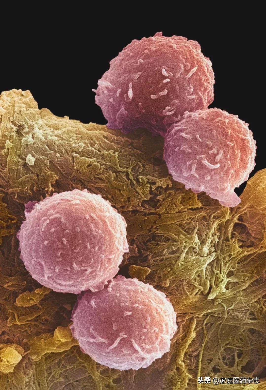 鍋囧鐥呮瘨鎰熸煋浜嗘垜,鍋囧鐥呮瘨鎰熸煋浜嗕綘