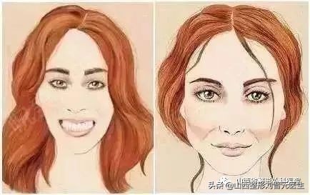 肉毒素假的有效果么,肉毒素有什么要注意的