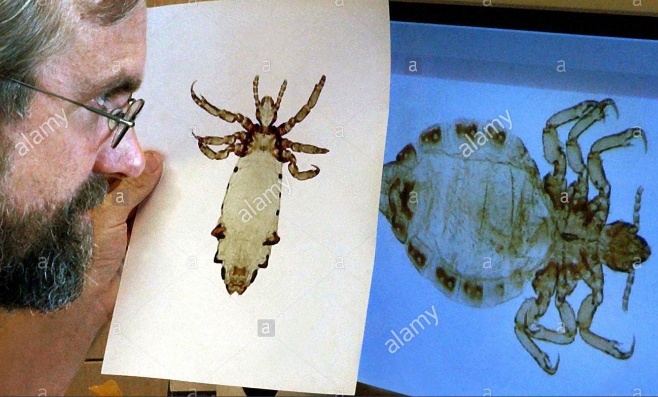 阴毛、腋毛和头发，人类在进化中为何保留了这几个部位的毛发？