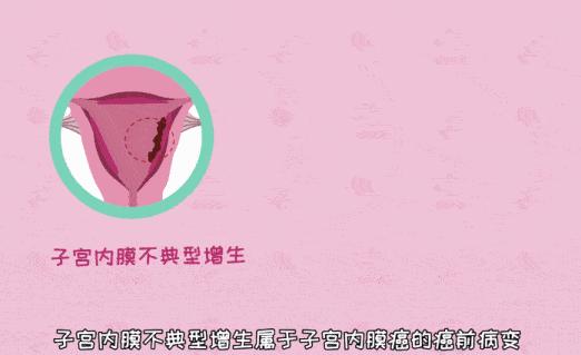 大姨妈来两次会不会得癌症,来大姨妈怎么查癌症