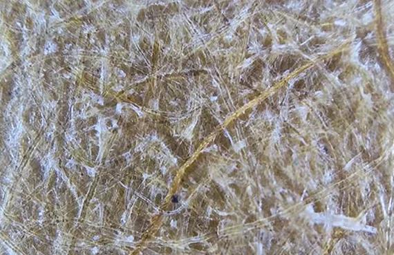 华为手机显微镜放大1000倍清晰,怎样才能把手机变成显微镜模式