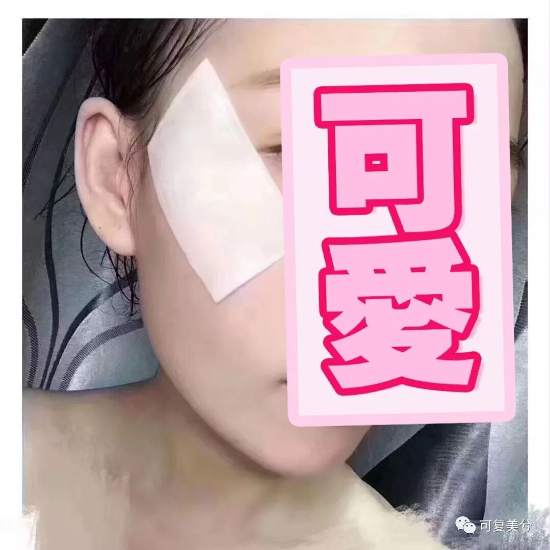 便宜的1000多，贵的10000起步，祛斑套餐的差距咋这么大？