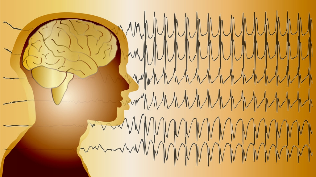 老年人癫痫病最好的治疗方法,老年人得了癫痫病能活多久