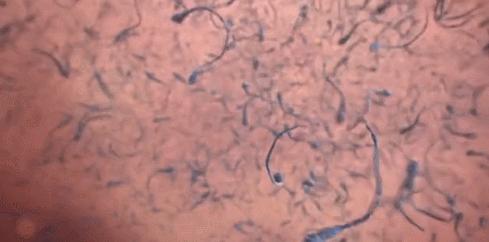 关于精子卵子结合的纪录片,精子卵子结合讲解视频