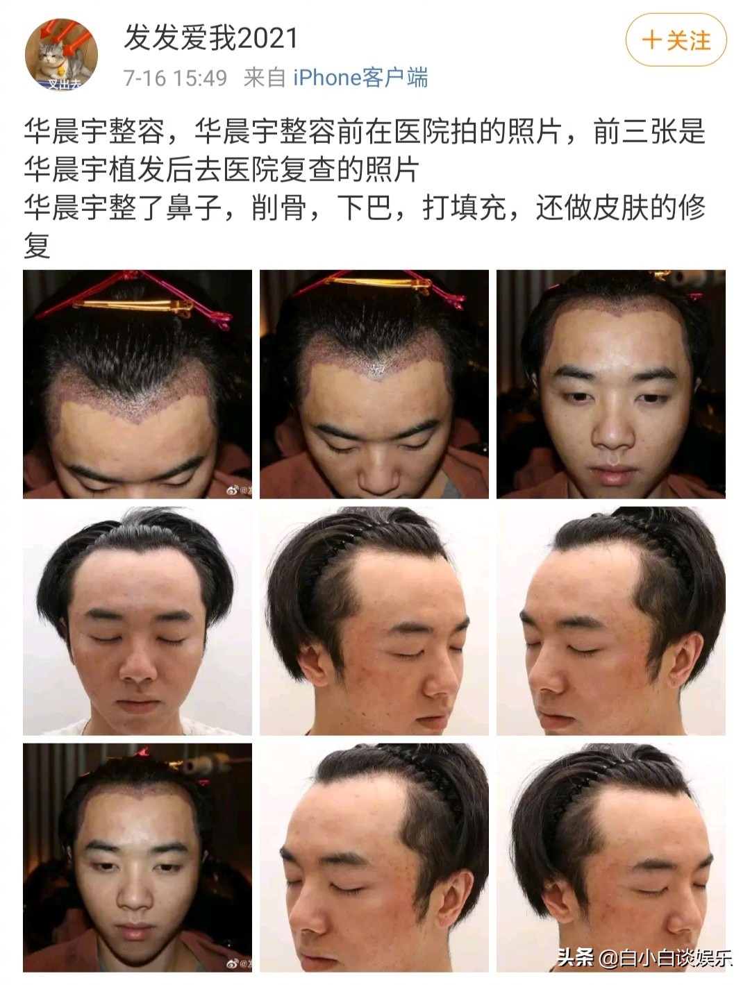 华晨宇回应与张碧晨绯闻,华晨宇与张碧晨最早绯闻