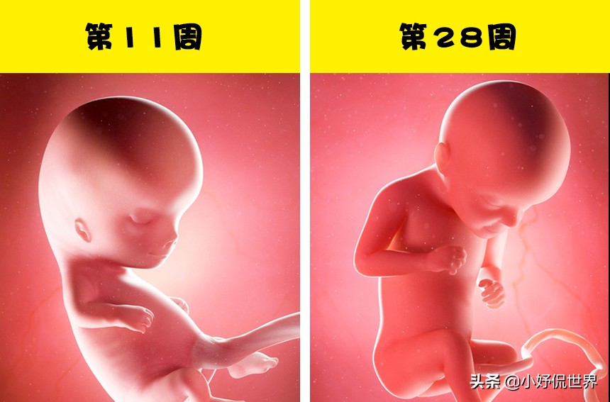 分娩知识,孕妇分娩宫缩知识