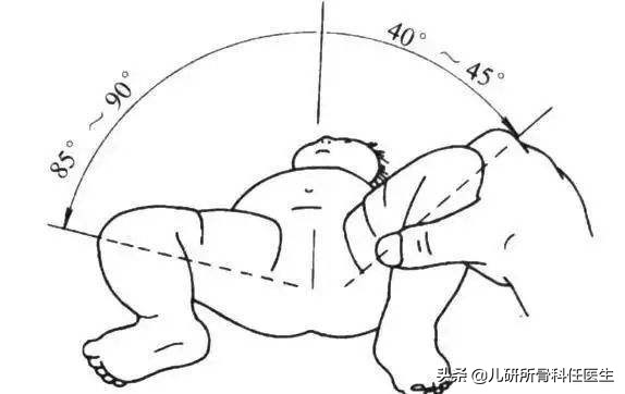 孩子臀纹不对称，看完门诊还是不明白？一次性解答你所有问题